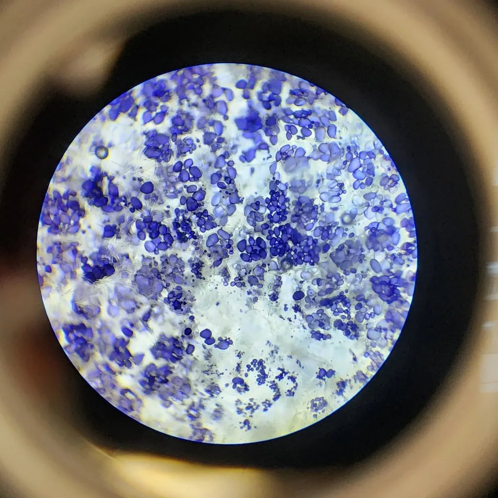 Dense crystalline growth under the microscope, lit in cold blue and white.